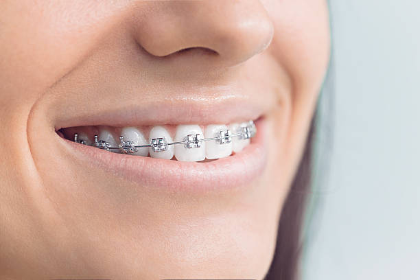 Trusted Heflin, AL Dental Services Experts